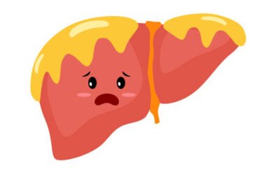 Non-Alcoholic Fatty Liver Disease (NAFLD) Causes & Diet Reversal